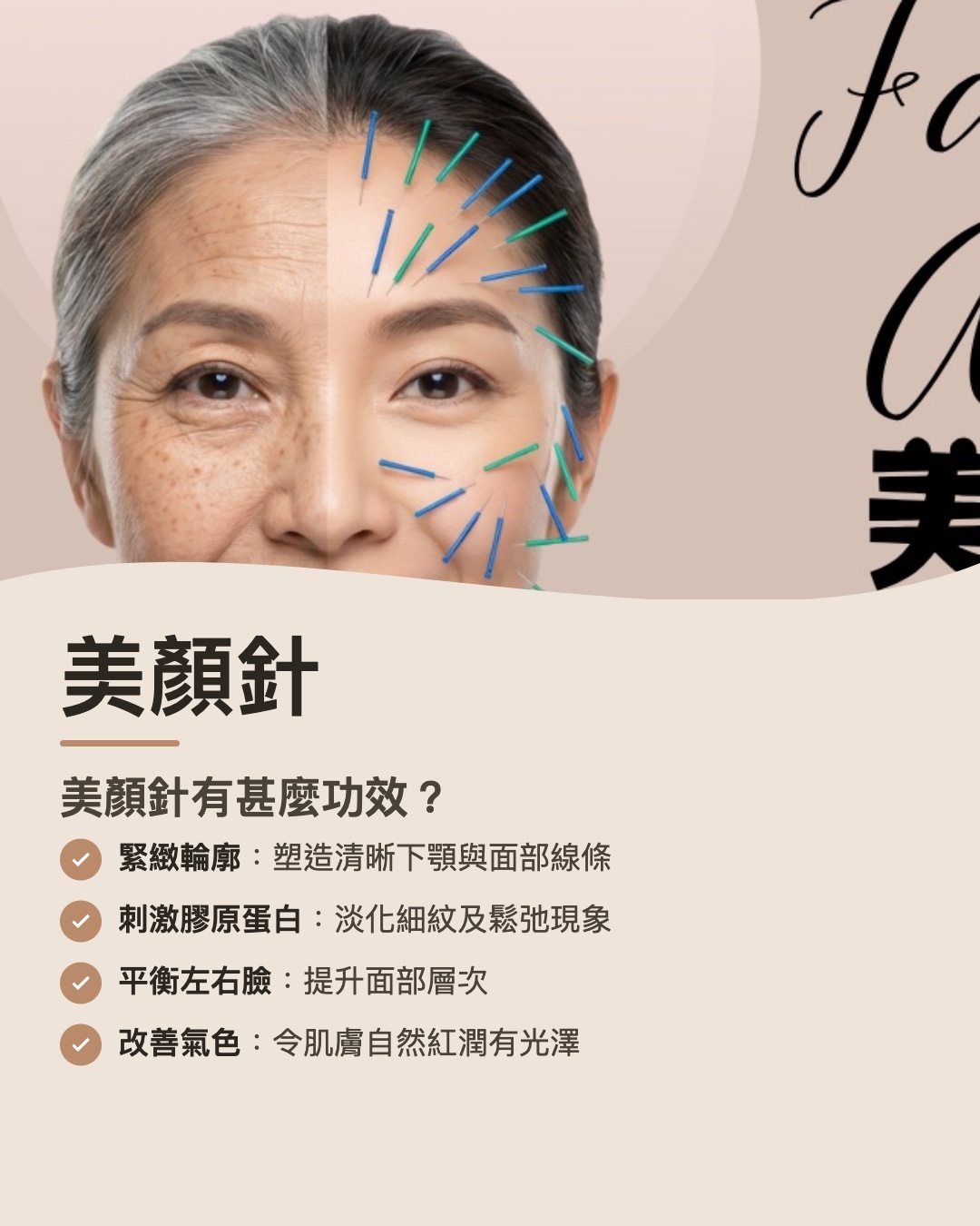 美顏針 Facial Acupuncture