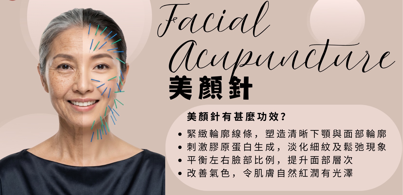 美顏針 Facial Acupuncture